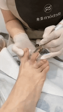 Pedicure