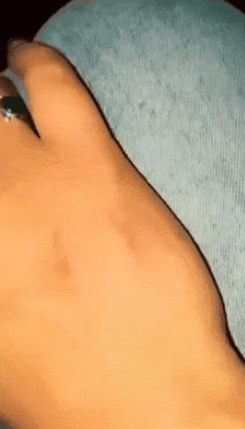 Little girl and bitten hand