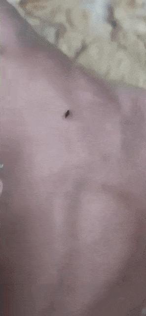 Mosquito and electricity